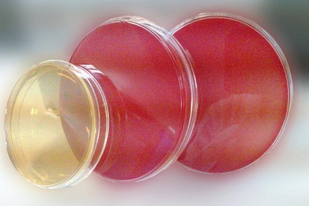 Agar Salmonella Shigella (SS): o meio essencial para o isolamento de patógenos