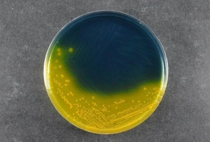 Garantir a segurança alimentar: o Agar Salmonella Shigella de Babio (SS) suporta padrões globais de detecção de patógenos