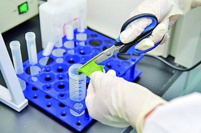 Identificação bacteriana confiável simplificada com o kit de mancha grama de Babio
