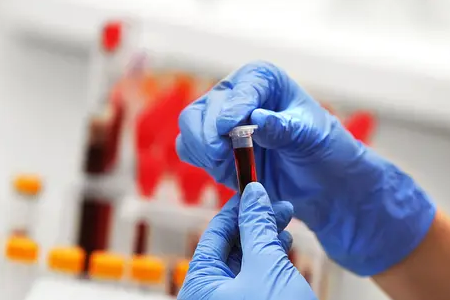 BABIO lança teste rápido de fluorescência para gravidez bovina