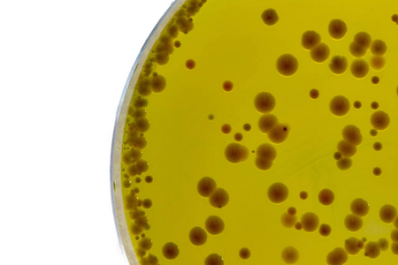 O caldo BABIO Mueller-Hinton suporta testes confiáveis ​​de suscetibilidade antimicrobiana